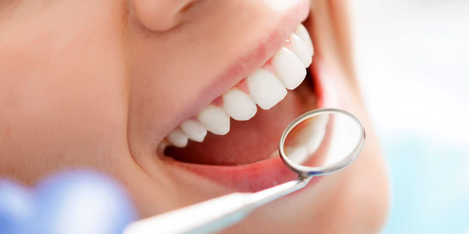 Sarro Placa Y Cálculo Diferencias Infinity Dental
