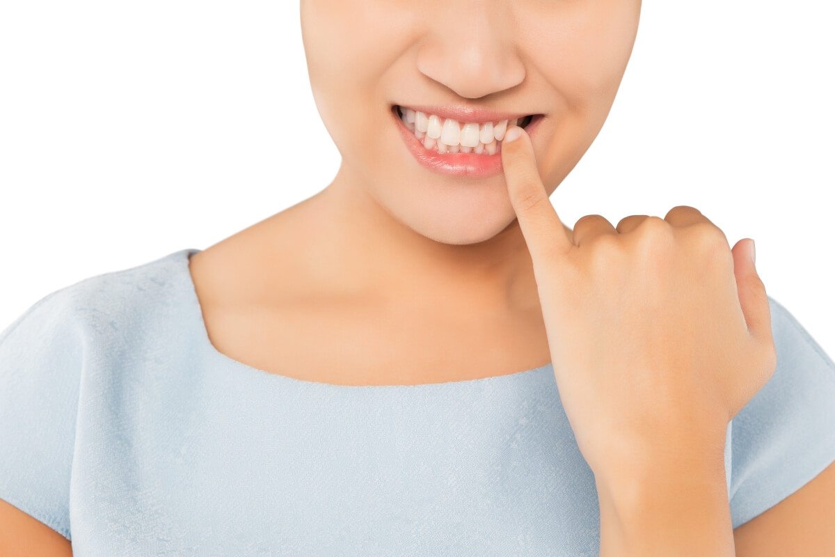 Irritacion De Encias Tras Blanqueamiento Dental